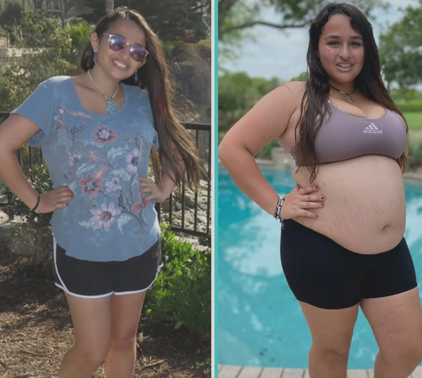 Jazz Jennings Shines: A Journey of Self-Love and Empowerment in Her 70-Pound Weight Loss Triumph