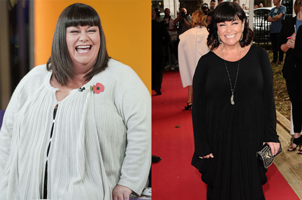 Dawn French weight loss: How Dawn lost seven and a half stone!